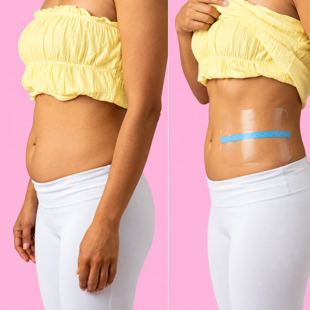 Minea Skin - Cintas Lifting Para El Abdomen